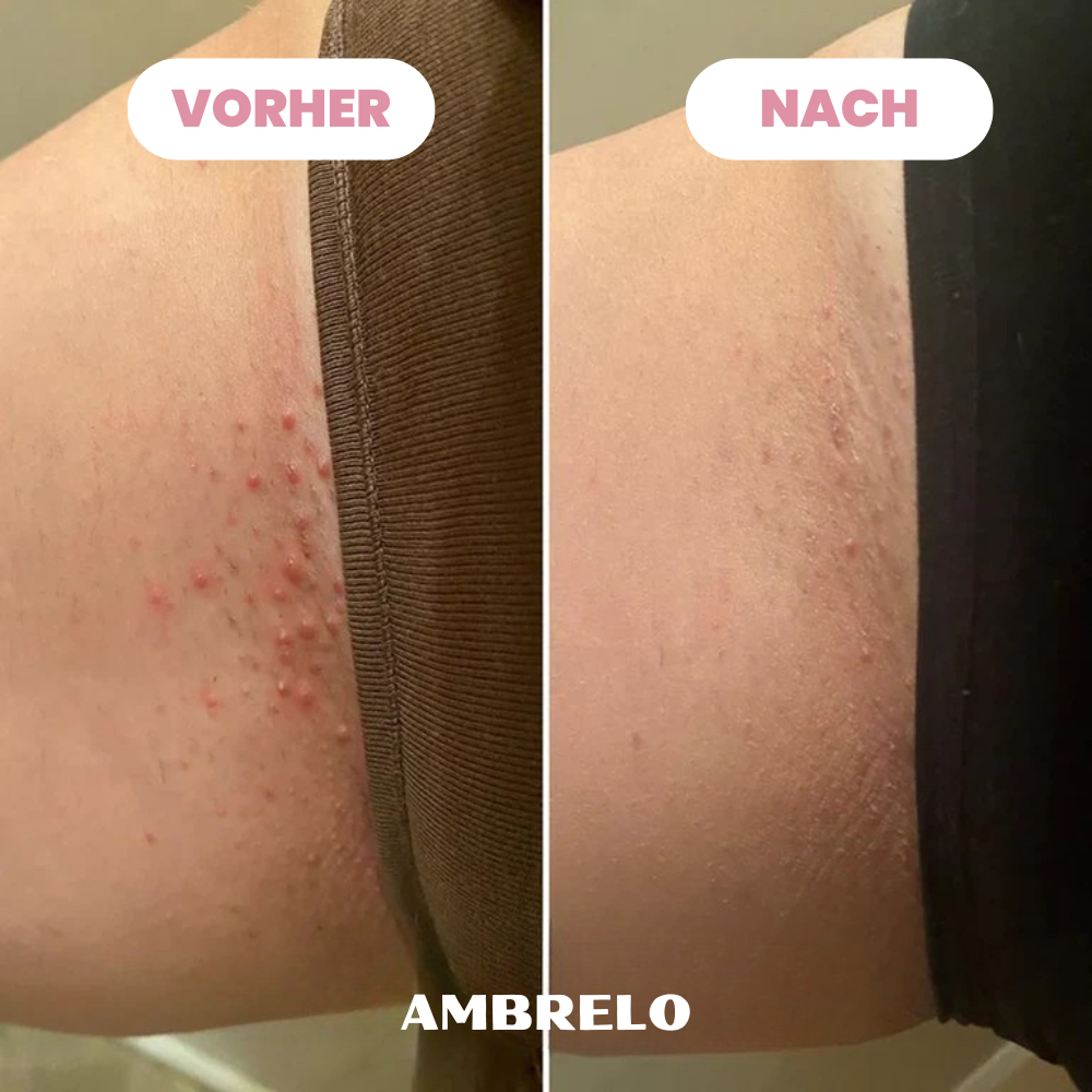 Ambrelo™ Rasierer