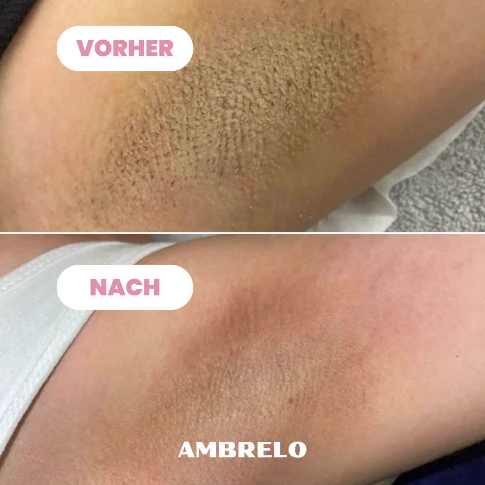Ambrelo™ Rasierer