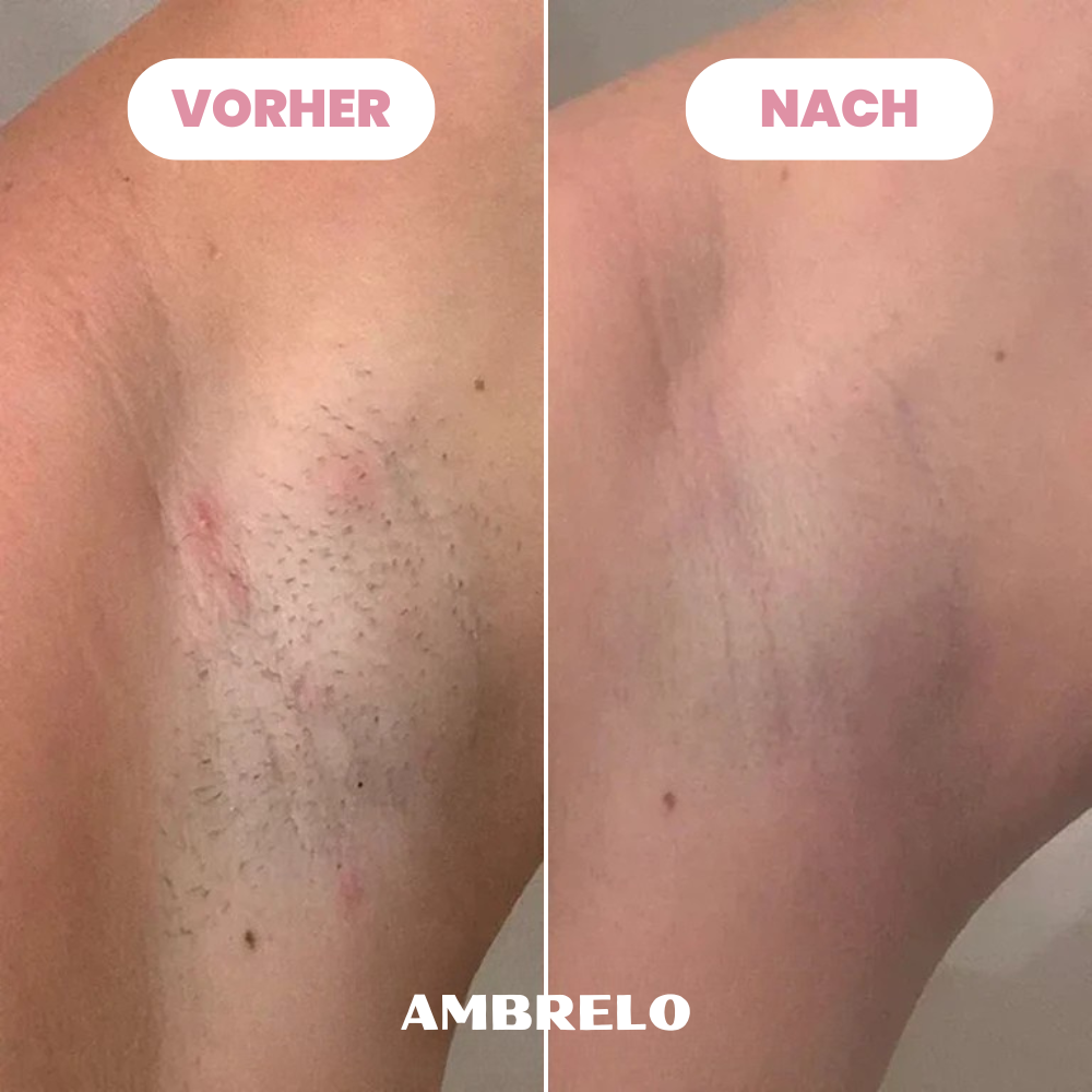 Ambrelo™ Rasierer