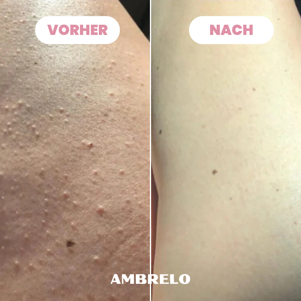 Ambrelo™ Rasierer